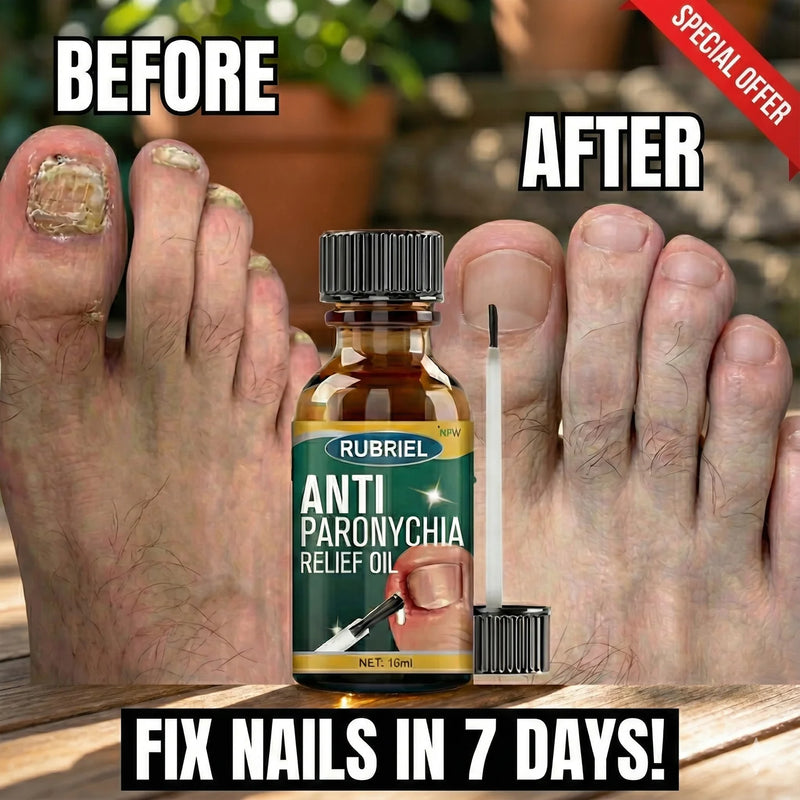 Anti Paronychia Relief Oil- Buy 1 get 1